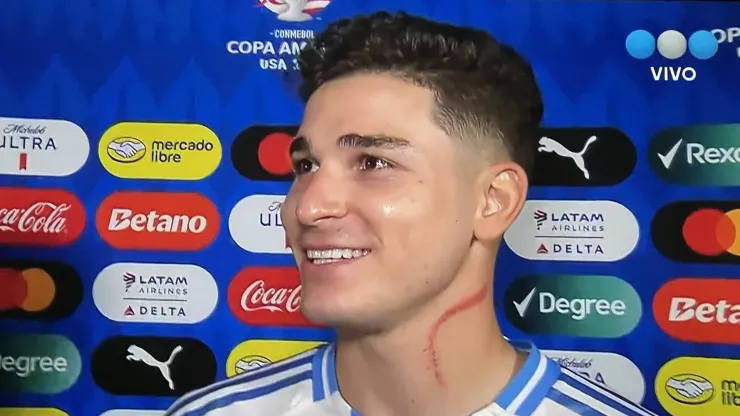 image?src=https%3A%2F%2Fimages.bolavip.com%2Fwebp%2Far%2Ffull%2FBAR_20240621_BAR_184744_julian-1-e17