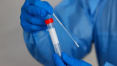 O doping é uma realidade bastante presente nos Jogos Olímpicos (Foto: Getty Images)