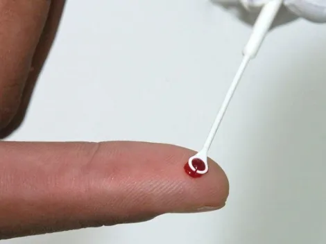 Reconhecimento: USP integrará rede global para encontrar a cura do HIV