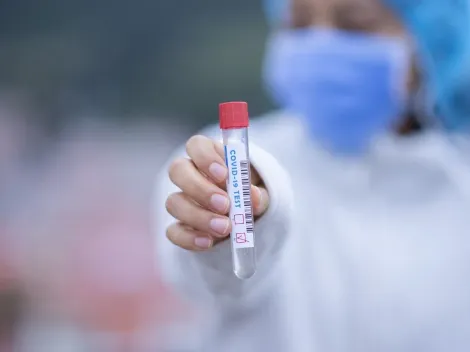 Testes rápidos de Covid-19 serão cobertos por planos de saúde; a obrigatoriedade entrou em vigor nesta quinta-feira (20) pela ANS