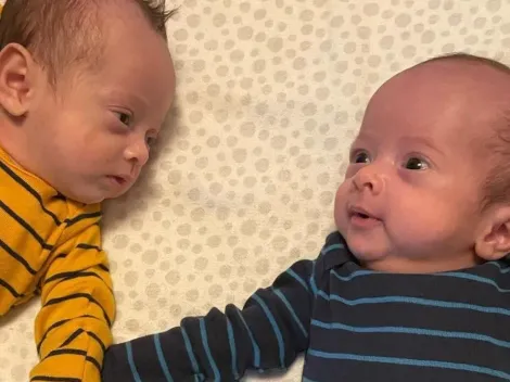 Gêmeos brasileiros nascem em dias e em estados diferentes