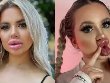 Modelo do OnlyFans gasta R$ 315 mil em plásticas e surge diferente