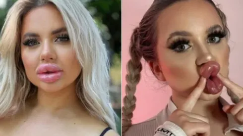 Modelo do OnlyFans apostou em plásticas. Foto: Reprodução/Instagram oficial Jessy Bunny