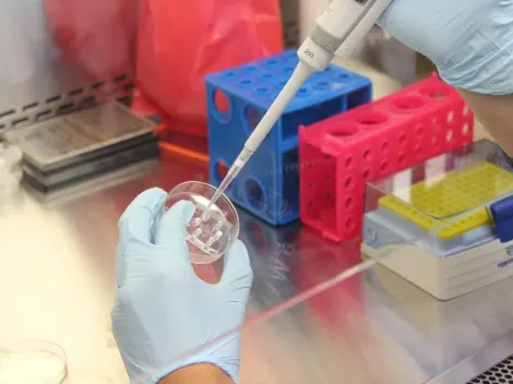 Sars-CoV-2 altera o RNA das células infectadas, revela estudo