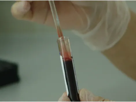 Chega ao Brasil uma nova vacina que pode combater lesões cancerígenas