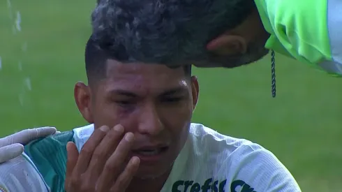 Foto: Reprodução - Rony levou olho roxo em vitória