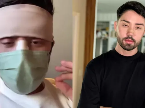 Após receber críticas, Rico Melquiades divulga resultado de cirurgias