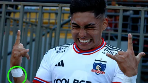 El delantero de Colo Colo se borró un curioso tatuaje