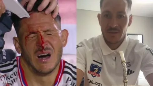 Ramiro González se refirió a la lesión que sufrió en el amistoso de Colo Colo vs Rosario Central. (Foto: Captura)