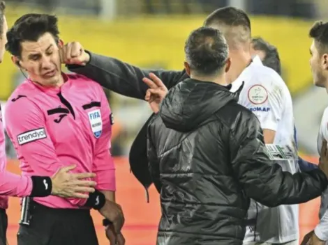 Turkish president calls referee that was brutally assaulted