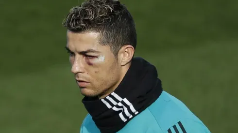 A Cristiano Ronaldo le quedaron secuelas en su ojo.