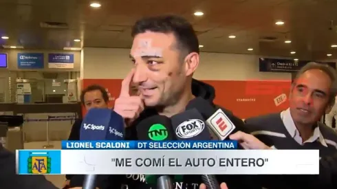 Scaloni llegó al país y habló de como fue su accidente.