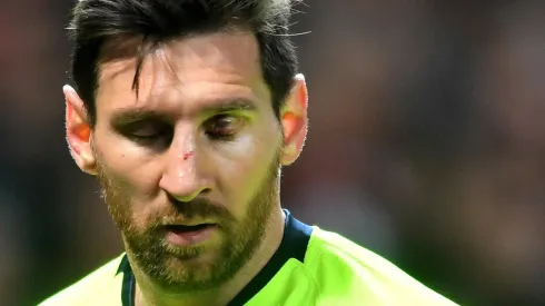 Así quedó el rostro de Lionel Messi.