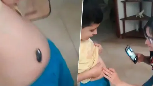 Video viral: nene se tragó un imán y su familia encontró una solución diabólica
