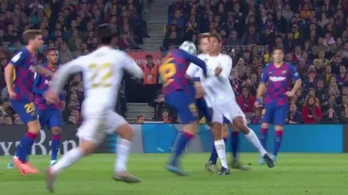 Así quedó la pierna a Varane después de la plancha de Lenglet