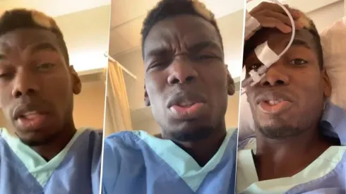 Luego de operarse, Pogba subió una historia completamente dopado: "Todavía sigo vivo"