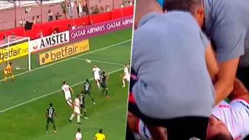 Video: Grimi hizo un gol con el hombro dislocado