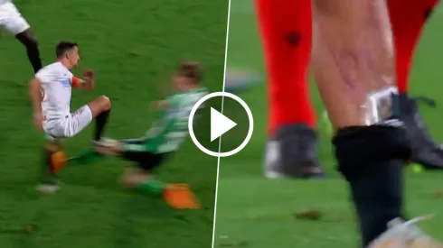 VIDEO | la temible patada que destrozó la pierna de Jesús Navas