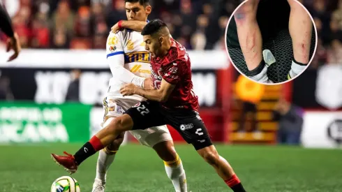 Jesús Angulo recibió cinco faltas ante Tijuana.