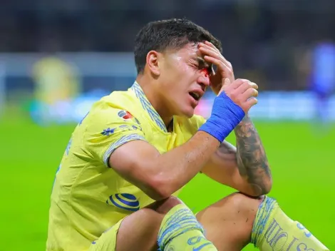 ¿Por qué Alejandro Zendejas jugará con máscara el clásico de América vs. Cruz Azul?