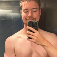 El radical cambio físico de MrBeast