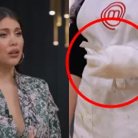 Una participante se quemó la mano y tuvo que ser atendida