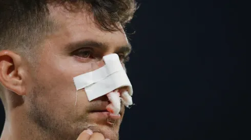 Así quedó el rostro de César Fuentes tras recibir el fuerte codazo de Ariel Martínez.