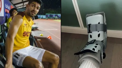 La lesión de Nelson Bonilla es más grave de lo que se esperaba