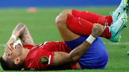 Ronald Matarrita muestra cómo quedó su tobillo tras plancha de Kaye