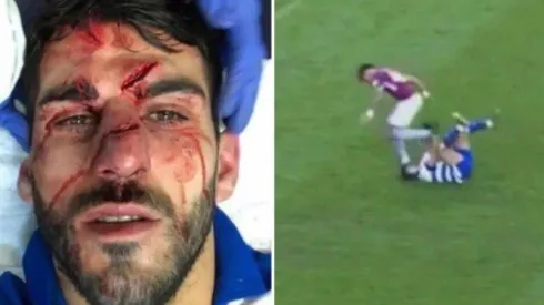 Así quedó Oliveira después del criminal pisotón