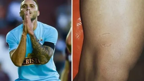 Jugador peruano mordió la pierna de Emanuel Herrera