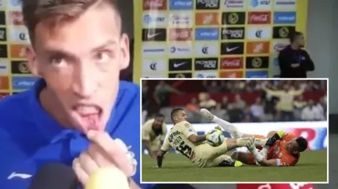 Vikonis muestra como le quedó el labio tras la patada de Castillo