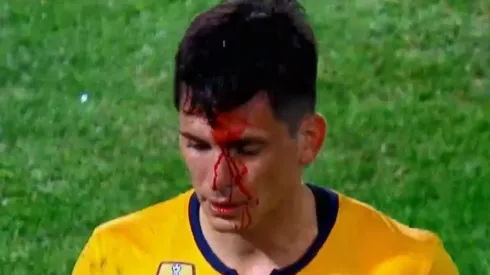 Parot se llevó flor de codazo en la final de la Supercopa argentina