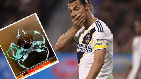 ¿Pelota o mala onda? Ibrahimovic fractura a rival en el clásico de Los Ángeles (Foto: Getty Images y Amro Tarek)