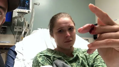 Ronda Rousey casi pierde un dedo en grabación de 9-1-1