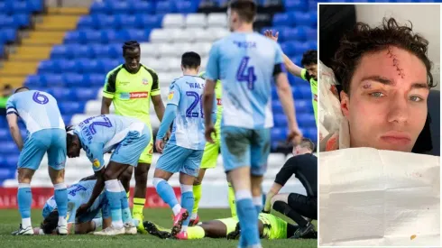 Tremendo: futbolista inglés sigue jugando pese a tener su cara completamente cortada