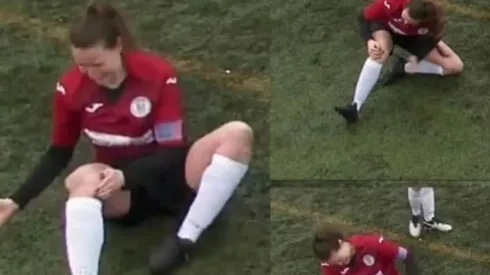 La futbolista sufrió una dolorosa lesión y siguió jugando el partido.