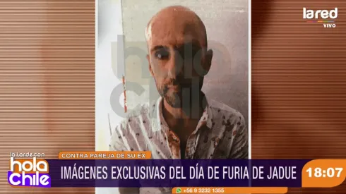 Jadue terminó ensangrentado.