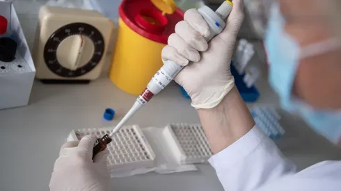 El estudio analizó a 37 personas asintomáticas y 37 sintomáticas.