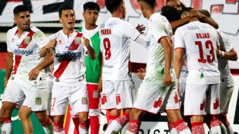 Curicó Unido está monitoreando de cerca la evolución de salud del jugador afectado por el virus respiratorio.