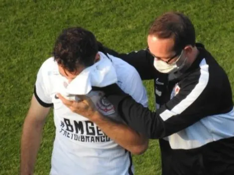 Video: Delantero de Corinthians sufre grave fractura en la cara