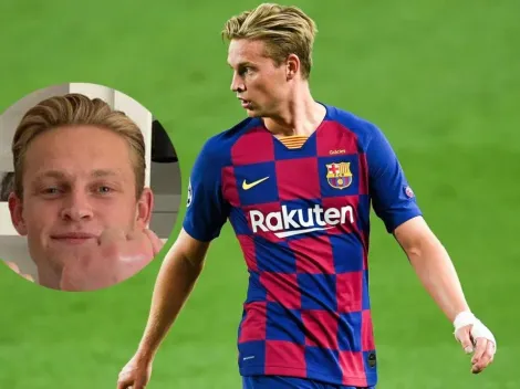 A De Jong lo picó una abeja: le dejó la mano como empanada