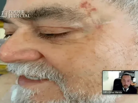 Calderón padre cambia testimonio sobre el ataque de Nano