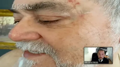 Parte de las heridas que le dejó Nano Calderón a su padre Hernán Calderón.