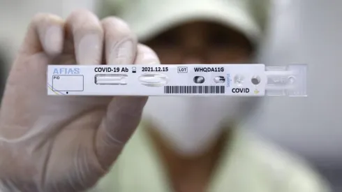 Presentan nueva prueba para detectar el covid-19 | Foto: Getty Images