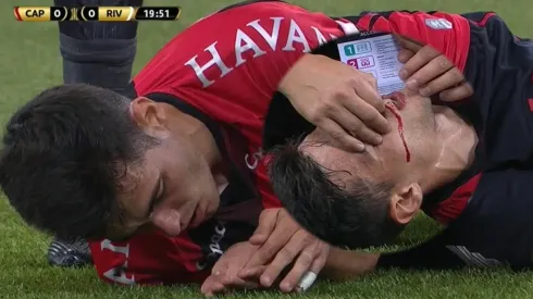 Santiago Sosa se llevó un diente de Léo Cittadini en el Paranaense-River Plate.