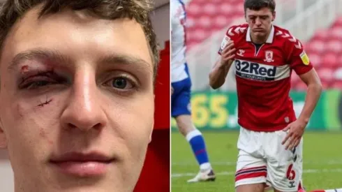 Terrible patada en la cara en Inglaterra