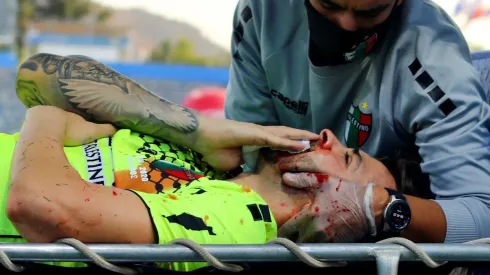 Federico Lanzillota se perderá lo que queda de temporada después de la dramática lesión que sufrió ante Universidad Católica