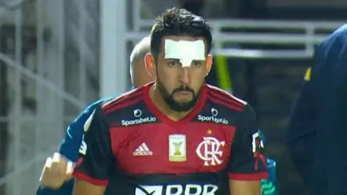 Mauricio Isla terminó evidentemente golpeado en el último partido de Flamengo.