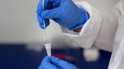 Toma de muestra de Test de Antígeno